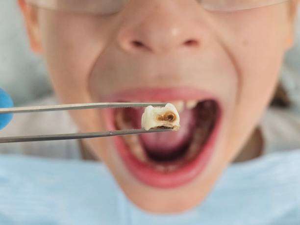Best Emergency Dental Surgery in St James, MD